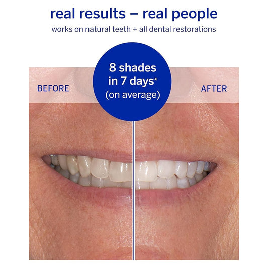 Supersmile Superstrips teeth whitening dissolving strips, 14-pack, for brightening teeth, shown in a close-up image.