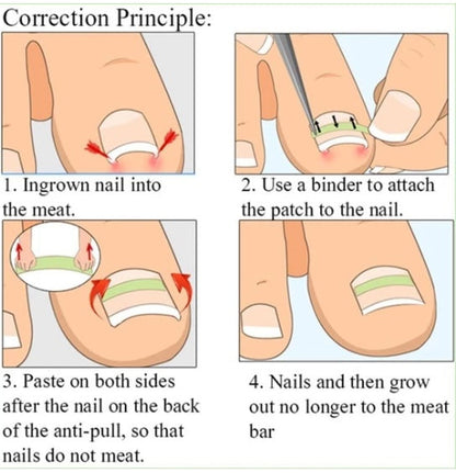 Nail patch by My Store, close-up product image showing adhesive nail wraps for easy application