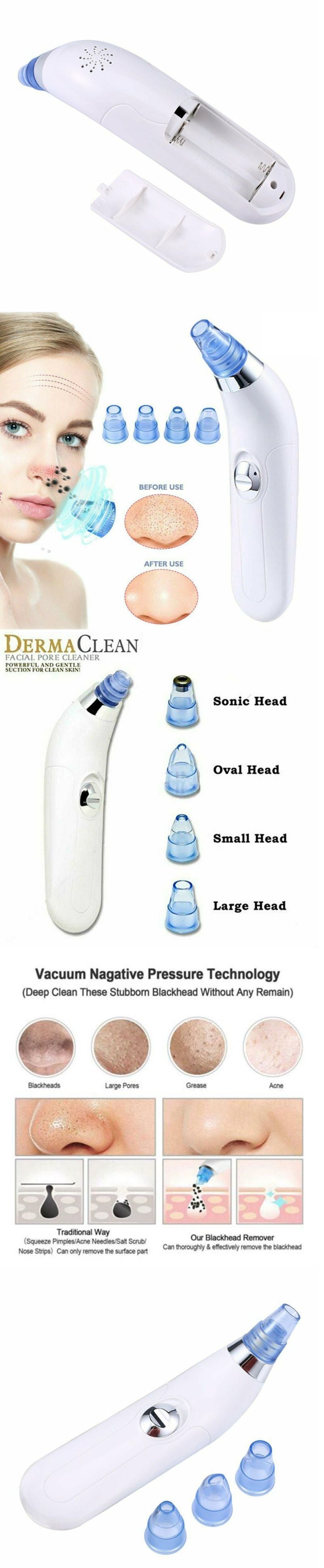 Blackhead electric pore extractor and blackhead cleaner device in black
