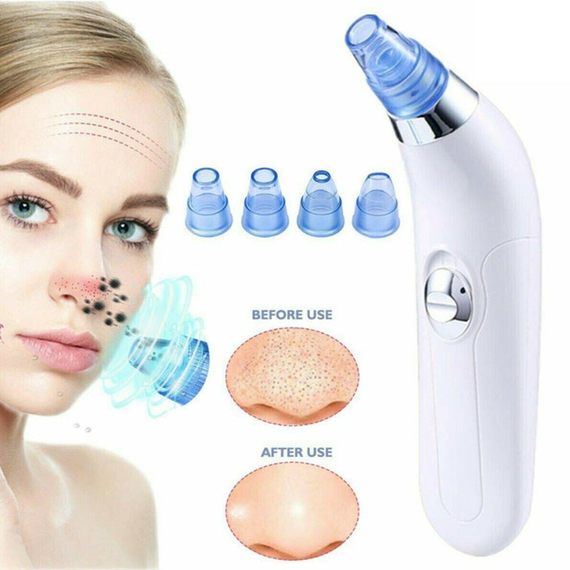 Blackhead electric pore cleaner with handheld suction design for removing blackheads and unclogging pores