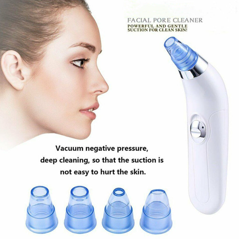 Blackhead electric pore cleaner, handheld blackhead remover with suction nozzle and compact design