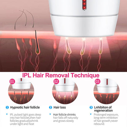 Home laser hair removal instrument by My Store in a compact handheld design
