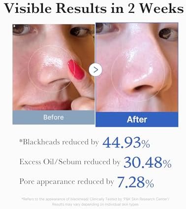 Medicube Zero Pore Pad 2.0 exfoliation toner pads for pore care, shown in a clear container with exfoliating texture