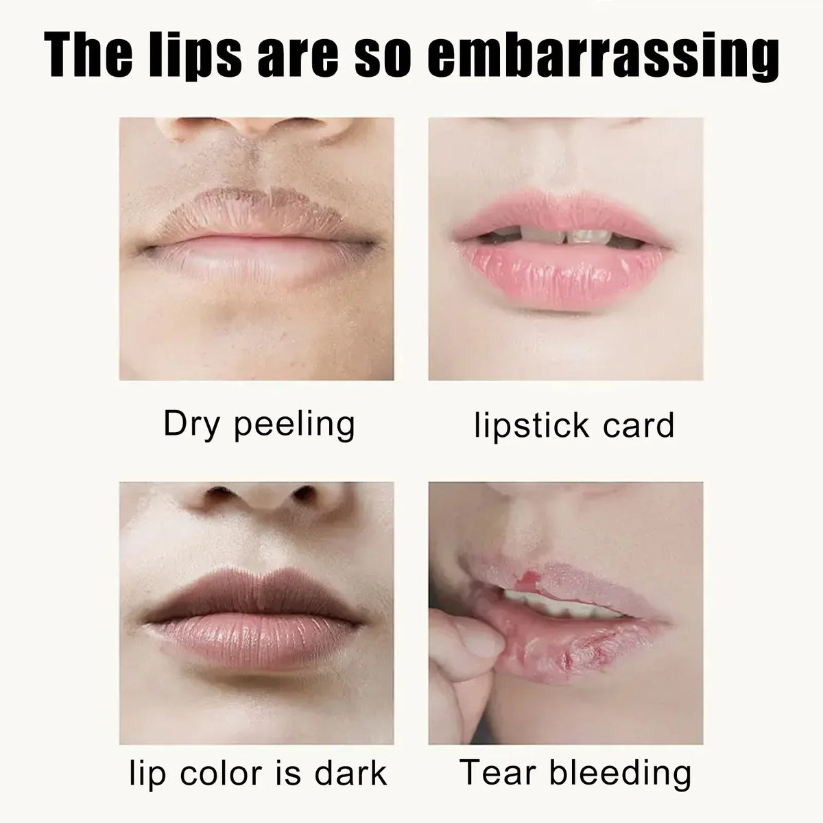 Blushimmer EELHOE Cherry Nourishing Lip Mask set with 5 moisturizing, smoothing lip patches for dry, cracked lips and line reduction
