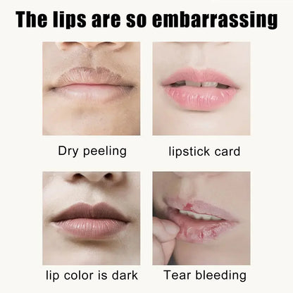 Blushimmer EELHOE Cherry Nourishing Lip Mask set with 5 moisturizing, smoothing lip patches for dry, cracked lips and line reduction