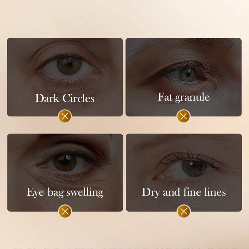 Blushimmer SADOER Snake Venom Peptide eye cream with caffeine for anti-wrinkle, dark circles, and anti-aging skincare.
