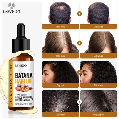Hair Growth Batana Oil Serum Fast Growing Hair Essential Oil Beauty Hair Care Anti-Hair Loss Essence Natural Repair Damaged Hair