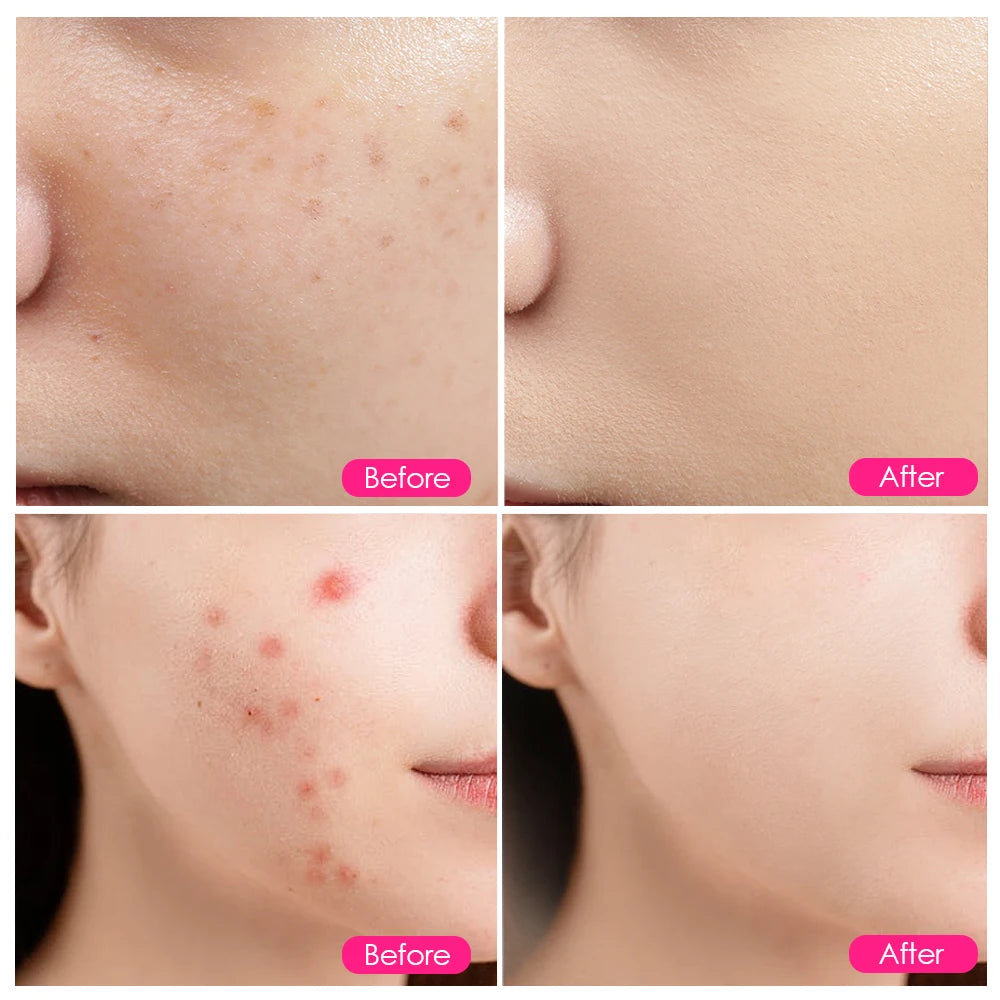 200 LEDs Infrared Light Therapy Lamp Skin Care Anti Aging 660nm 850nm Red Light Therapy for Full Body Facial Acne Treatment Spa