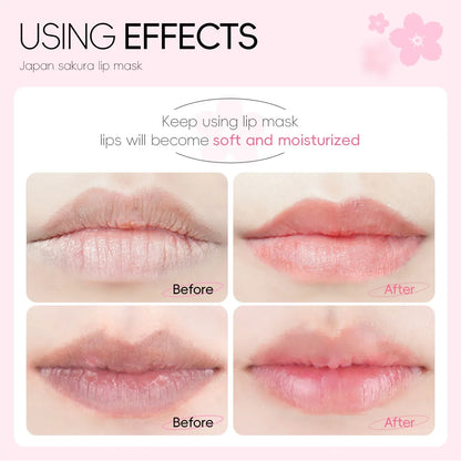 Blushimmer LAIKOU lip mask set with five or ten moisturizing, hydrating gel patches for repairing and softening lips.