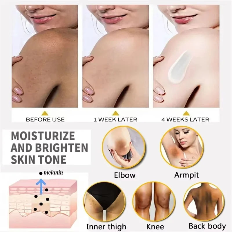 Whitening Cream Private Parts Underarm Bleaching Serum Whiten Butt Knee Brighten Inner Thigh Intimate Parts Dark Remove Melanin