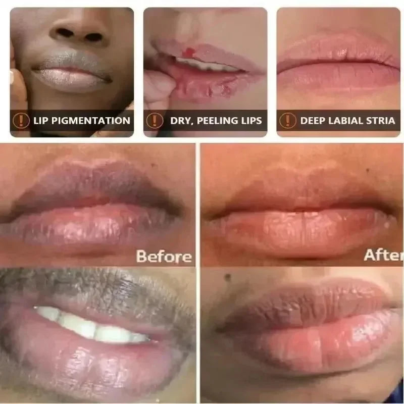 Blushimmer dark lip balm lightening melanin mask with pink gloss, exfoliates, reduces lip lines, moisturizes, and improves dryness.