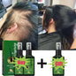 Fast Hair Growth Serum Spray Anti Hair Loss Prevent Baldness Scalp Treatment Repair Roots Beauty Health Hair Care For Men Women