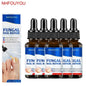 Nail Fungus Treatment  Serum Toe  Fungal Repair Products  Hand Foot Care  Removal Gel Anti Infection Paronychia Onychomycosis