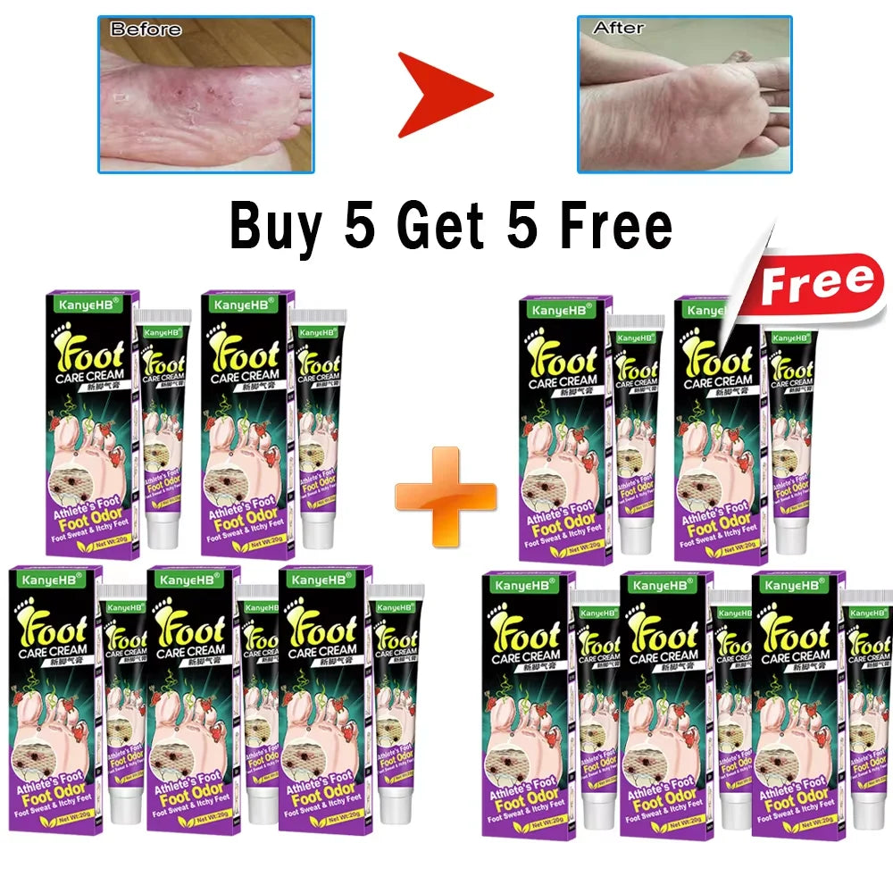 Anti-Foot Fungus Ointment Deodorant Care Products Foot Deodorant Creams Antiseptic and Antiperspirant Foot Skin Topical Cream