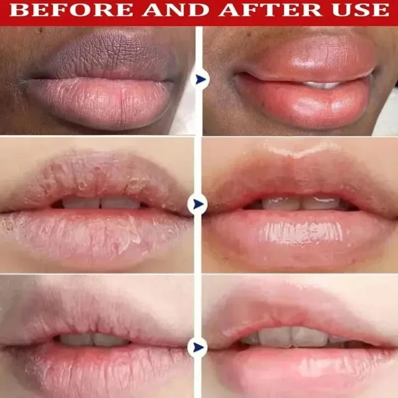 Blushimmer dark lip balm and melanin lightening mask with exfoliating pink treatment for moisturized, smoother lips