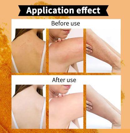 Natural Turmeric Scrub, For Face & Body, Brightening, Reduce Acne, Clean And Smooth Skin, Deeply Exfoliates, 250g/8.8 oz