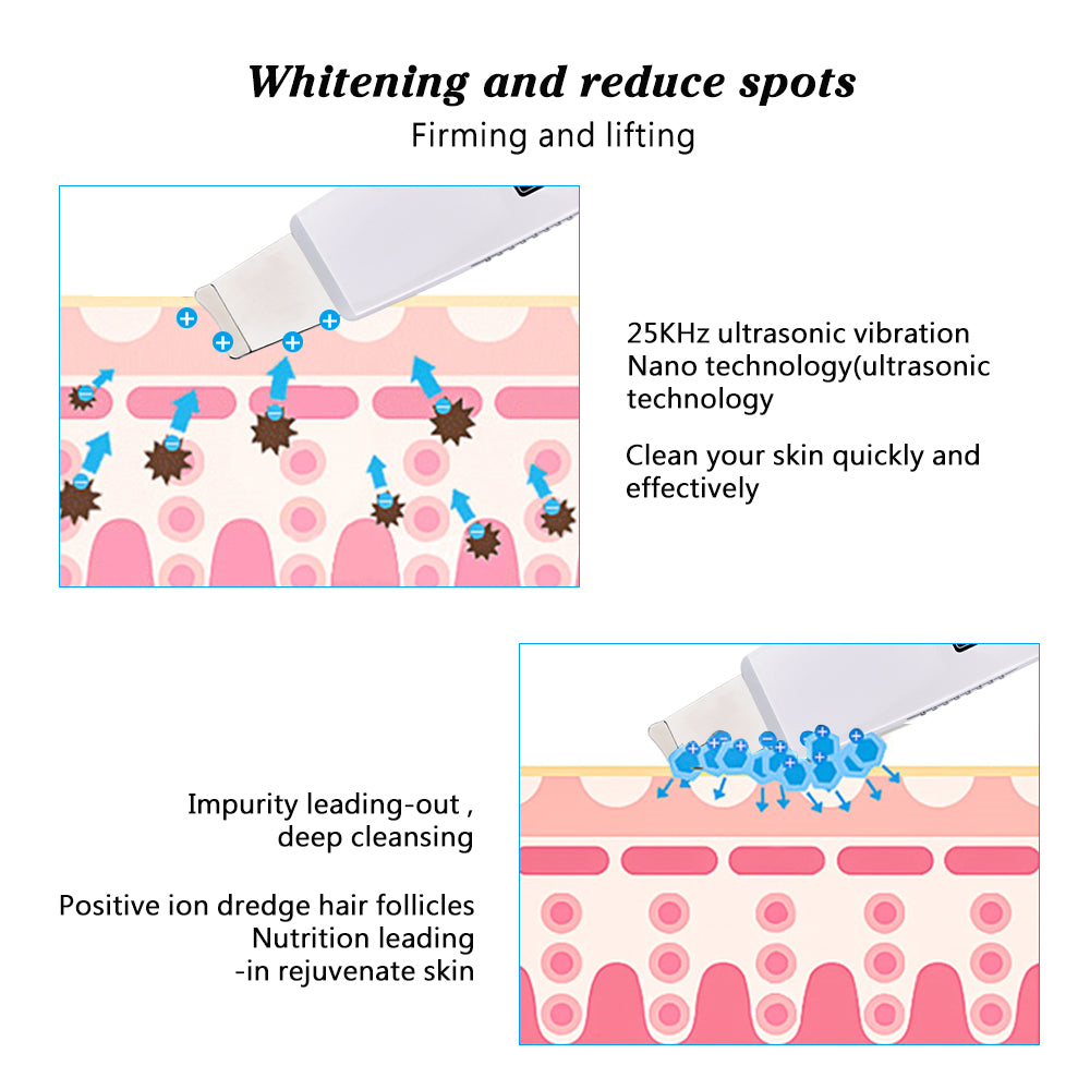 SonicGlow Skin Purifier & Pore Vacuum