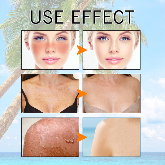 Hyaluronic acid moisturizing protective gel by My Store, refreshing non-oily summer skincare formula