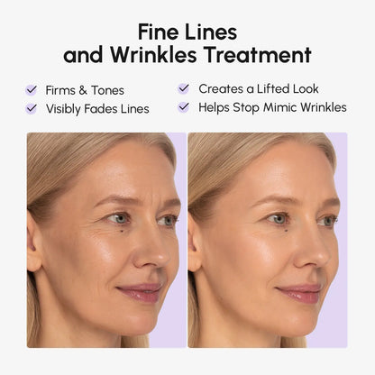 Maree anti-wrinkle tape patches shown on skin, designed to reduce wrinkles and smooth facial lines for a youthful appearance.