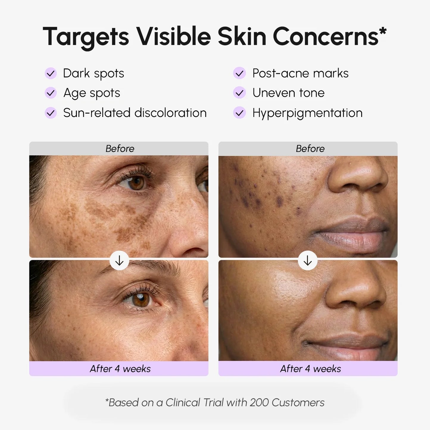 Maree Face & Body Serum for Dark Spots showing the serum bottle with applicator on a clean surface