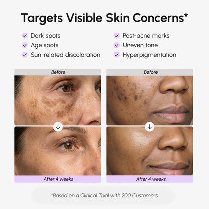 Maree Face & Body Serum for Dark Spots showing the serum bottle with applicator on a clean surface