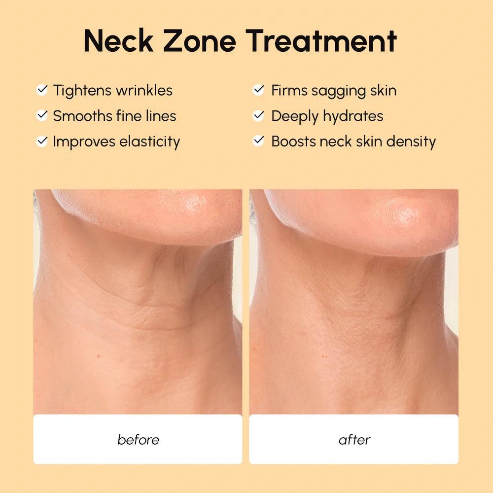 Maree Lifting Neck Wrinkle Patches shown on a person's neck, designed to reduce wrinkles and improve skin firmness.