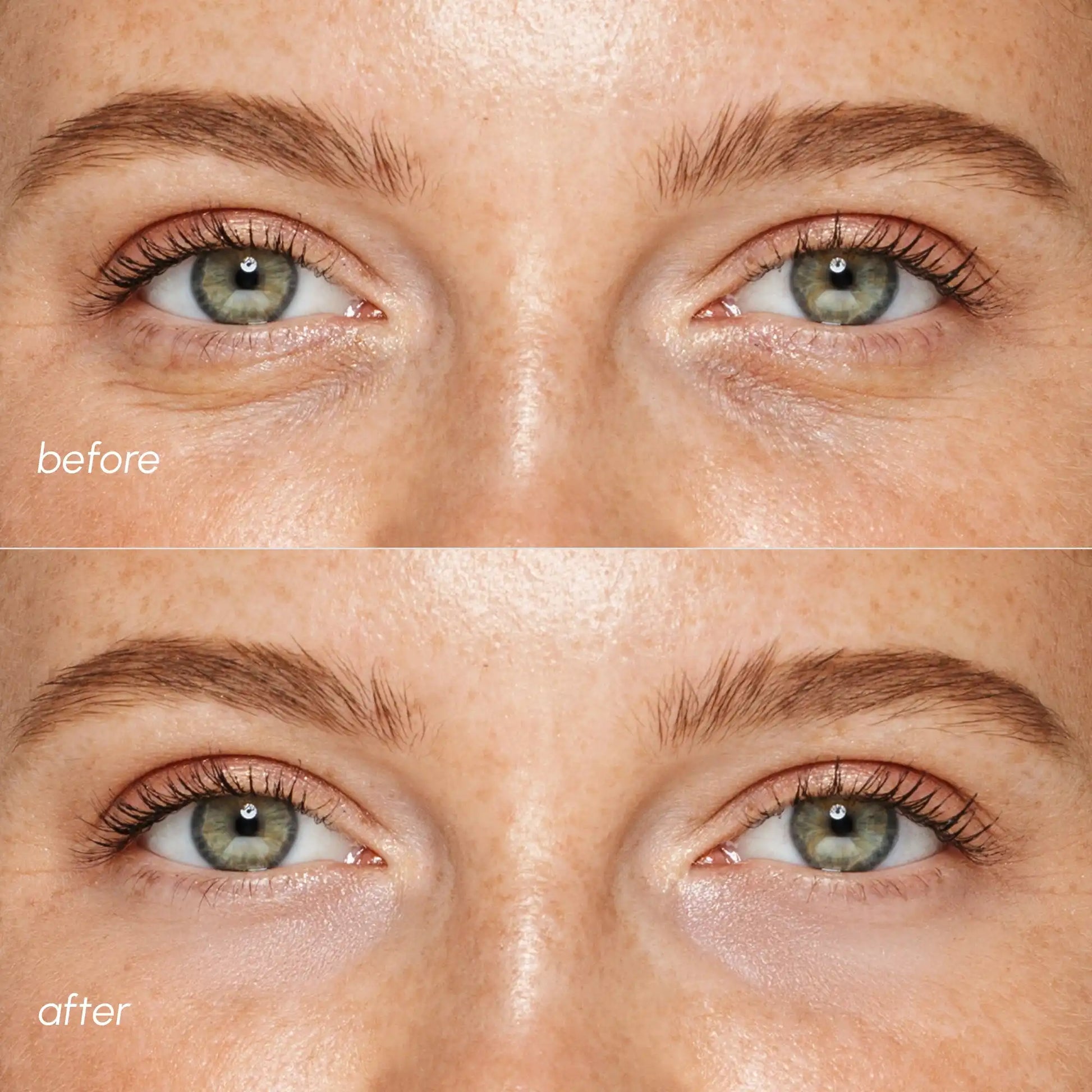 Maree pink eye patches for puffy eyes, showing soothing gel patches designed to reduce puffiness and refresh the eye area.