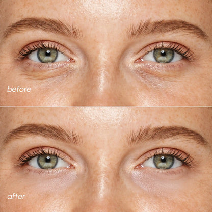 Maree pink eye patches for puffy eyes, showing soothing gel patches designed to reduce puffiness and refresh the eye area.