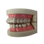 Archtek Grind Guard dental tray with 3-inch mirrored case, used for teeth protection and nighttime grinding, in a compact, clear container.