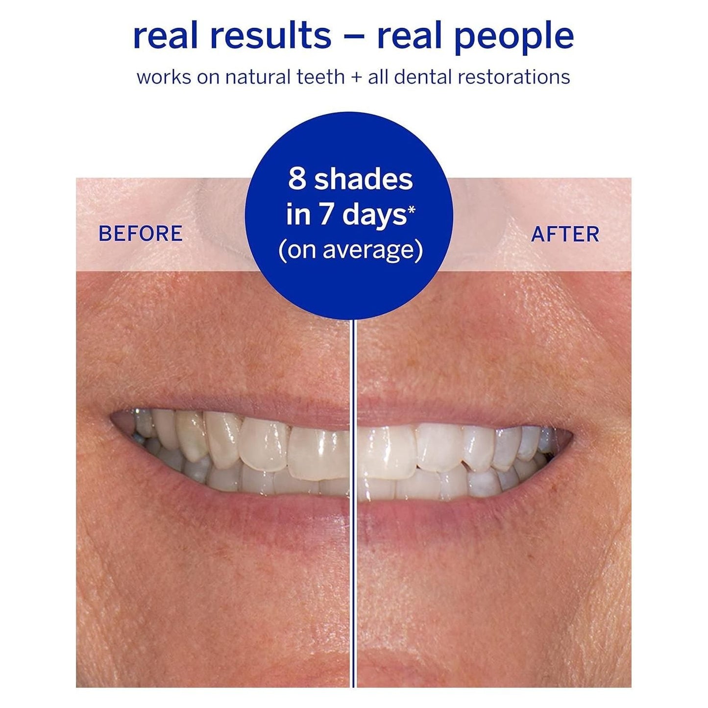 Supersmile Superstrips teeth whitening dissolving strips, 14-pack, for brightening teeth, shown in a close-up image.